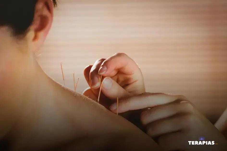 Acupuntura sem Mistérios: Desvendando Mitos Comuns Acupuntura sem Mistérios: Desvendando Mitos Comuns