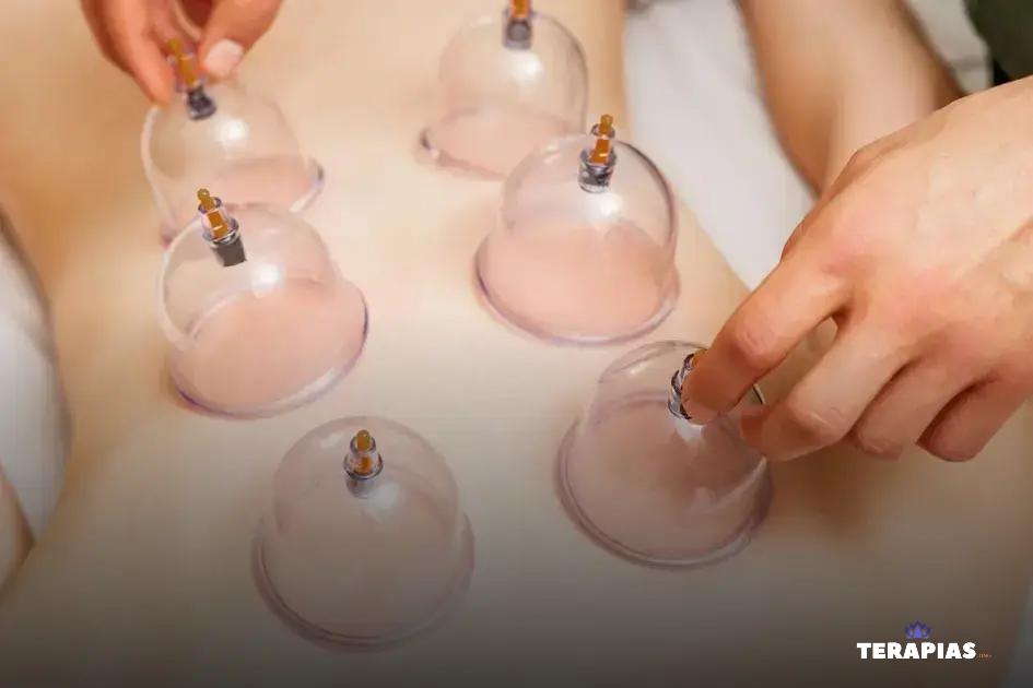 Quais são os tipos de métodos de ventosaterpia?